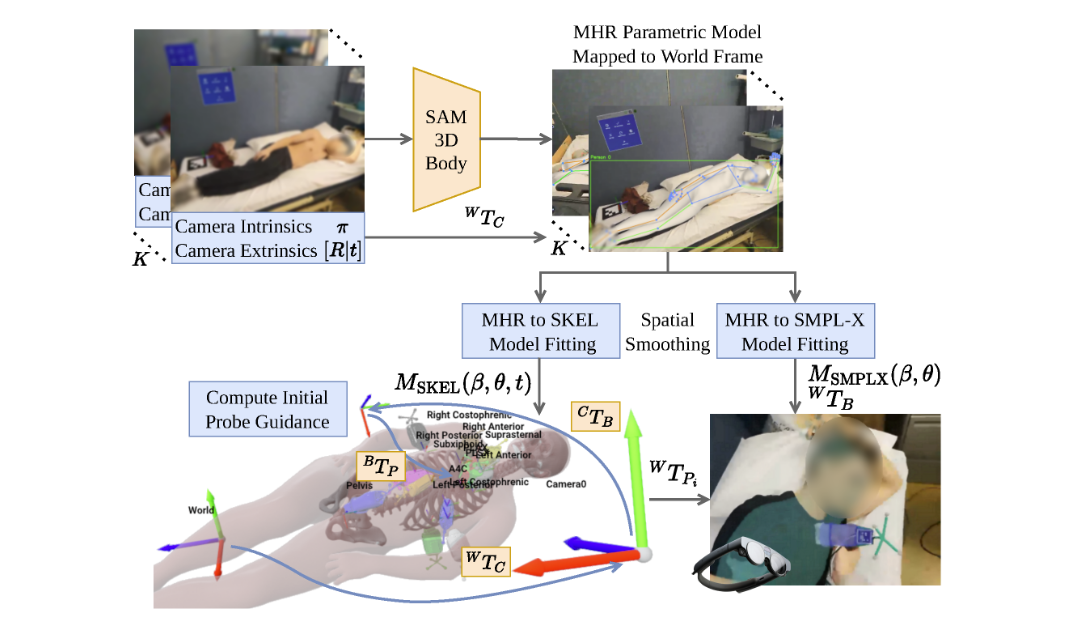 Towards Automated Initial Probe Placement in Transthoracic Teleultrasound Using Human Mesh and Skeleton Recovery